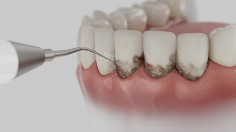 Reliable Dental Implants contractor in Baldwin, MI by Smile Center Dentistry